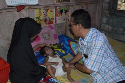 Kondisi Alveera Balita Asal Gresik Tergolong Gizi Kurang