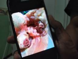 Kualitas Daging Ayam Jelek, Warga Keluhkan BPNT di Benjeng