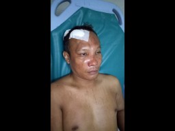 Istri Dikirimi Gambar Seronok, Suami Bacok Pria Pengirim