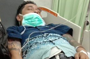 Gregetan, Pemotor Gigit Kuping Kondektur Bus di Krian Hingga Nyaris Putus