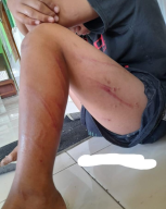 Segera! Polres Gresik Mulai Memeriksa Saksi-Saksi Kasus Pemukulan Anak Panti di Benjeng