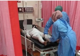 Suami Bakar Istri Gegara Tak Kuat Layani Hubungan Intim Sehari Lebih 5 Kali