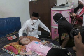 Wabup Pastikan Pengobatan Penderita Hidrosefalus Ditanggung Pemkab Sidoarjo