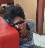 Agus Bonyok Dihajar Warga Jl Veteran Gresik Karena Kepergok Satroni Rumah Warga