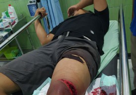 Pendekar Bacok Pendekar Terjadi di Gresik, Pelaku Masih Remaja, Begini Kronologinya