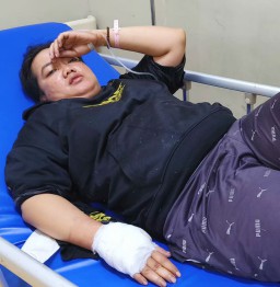 Aksi Pembegalan di Jalur Pandaan-Bangil Masih Misterius, Polisi Tunggu Korban Pulih