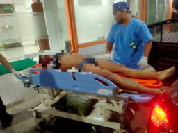 Terduga Maling Motor di Gresik Kota diamankan Polisi Setelah Babak Belur Dihajar Warga