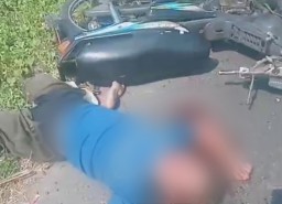 Jadi Korban Tabrak Lari oleh Truk Misterius, PNS di Jombang Ini Patah Kedua Kaki dan Cidera Kepala