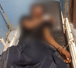 Diduga Hendak Curi Motor di Jember, Pria Ini Babak Belur Dihajar Warga, Temannya Kabur