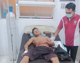 Pria di Jember Dianiaya Sekelompok Orang, Diduga Gegara Teguran soal Petasan