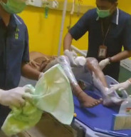 Main Meriam Kaleng Sambut Ramadan, Dua Remaja Sampang Masuk UGD