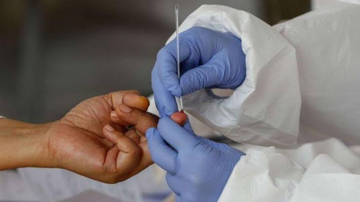 Juara Dua Tes PCR, Tiap 43 Warga Ada Satu Orang