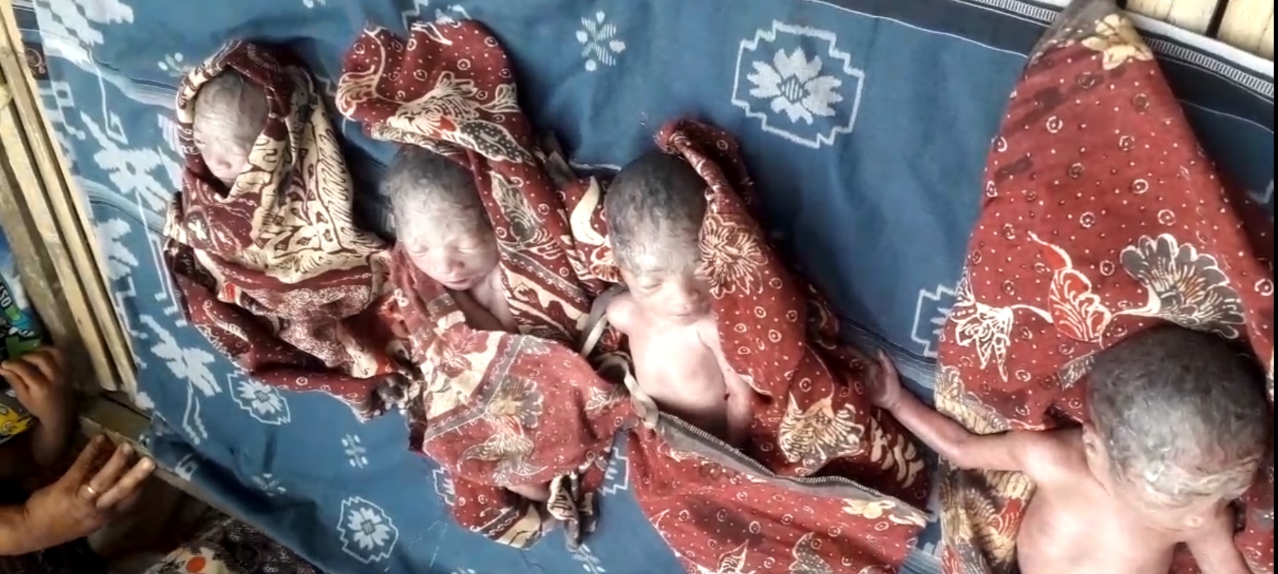 Ibu di Bangkalan Lahirkan 4 Anak Dibantu Dukun Bayi, Sayang Semuanya Meninggal Dunia